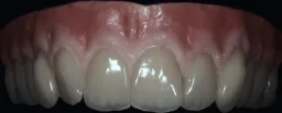 Hammaslaboratorio Dentiform